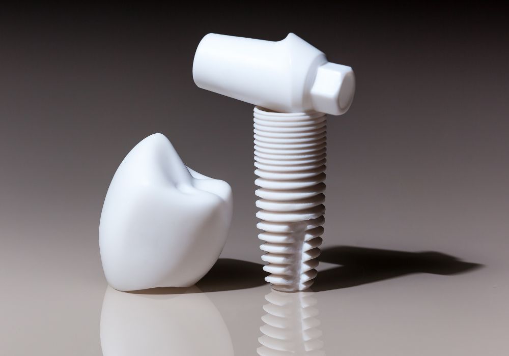 Dr Alexandru BARNA - Dentiste Granville - Implant dentaire